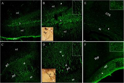 Temporal and structural sensitivities of major biomarkers for detecting neuropathology after traumatic brain injury in the mouse